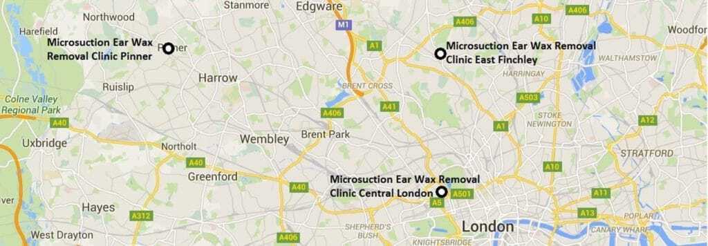 Map of Ear Wax Removal Micro Suction London Clinic Locations. Information On Where To Get Microsuction In London And Details Of Where To Get Ear Wax Removal London