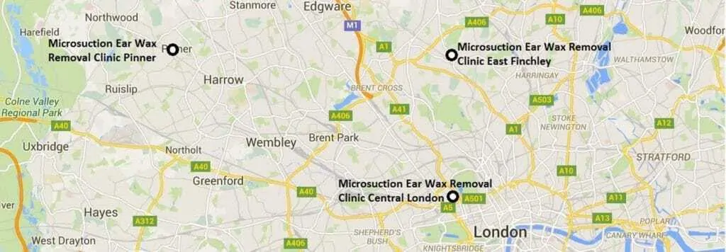 Map of Ear Wax Removal Micro Suction London Clinic Locations. Information On Where To Get Microsuction In London And Details Of Where To Get Ear Wax Removal London